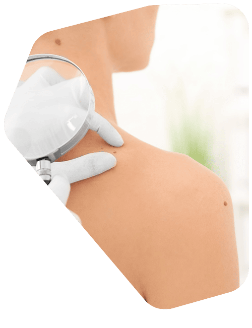 doctor-dermatologo.png