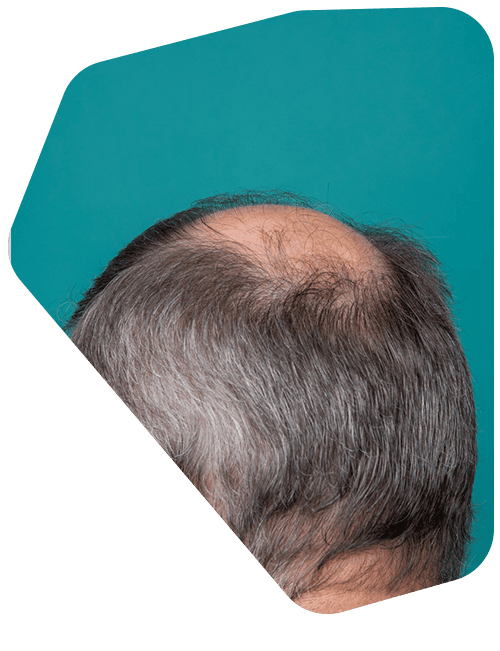 tricologo-para-problemas-de-cabello.png