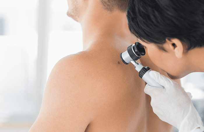 Consulta de dermatología clínica